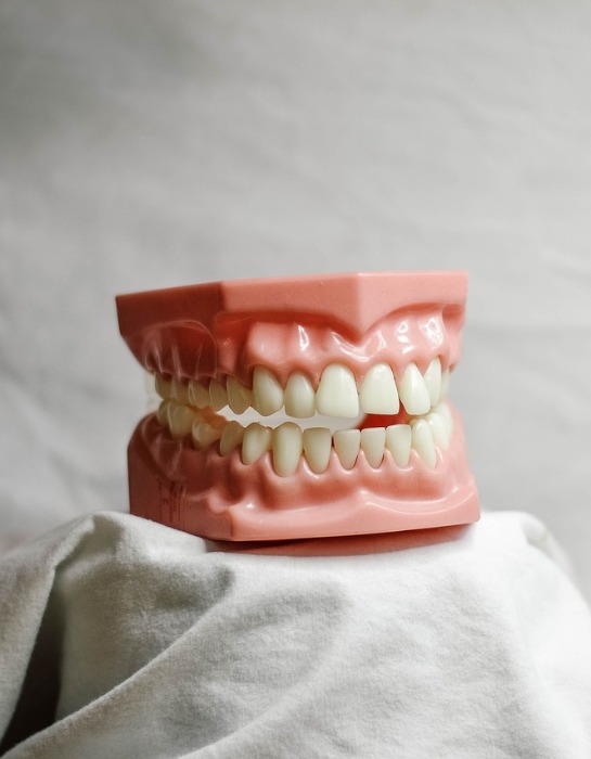 Imagen muestra prótesis dental.